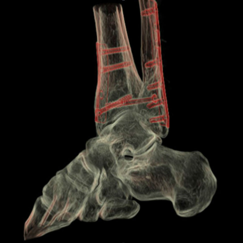 Illustration for article titled You Won't Believe How Accurate GE's New CT Scanner Is